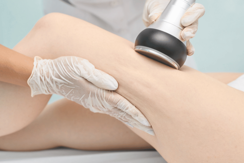 Laser Lipo Clinic in Auckland